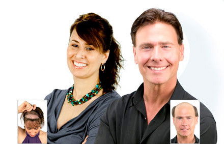 Hair Transplant Abroad - Melbourne Hairdresser 2