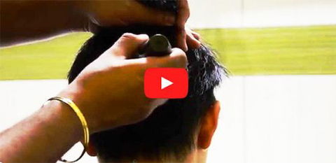 Hair Transplant Abroad - Melbourne Hairdresser 4